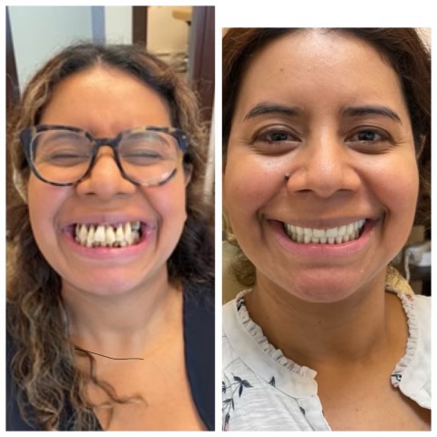 Smyle Upper East Side before and after transformation 4