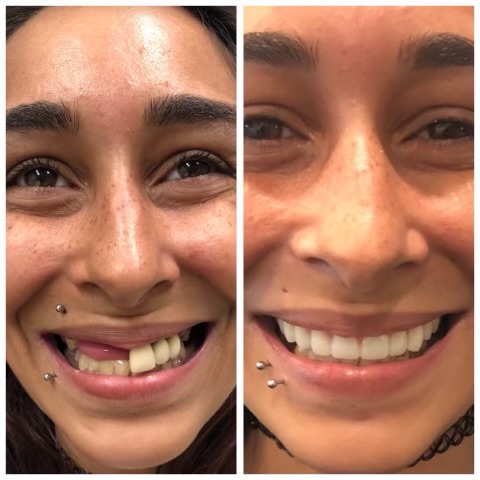 Smyle Upper East Side before and after transformation 5