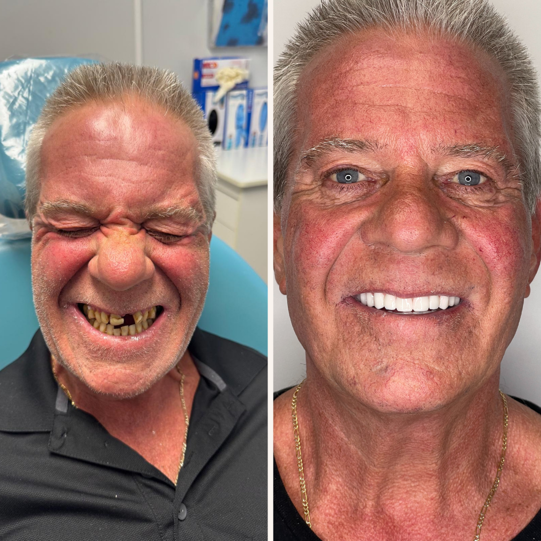 Smyle Upper East Side before and after transformation 1