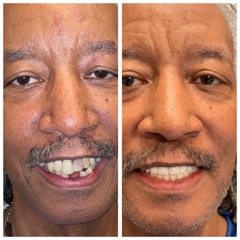 Smyle Upper East Side before and after transformation 7