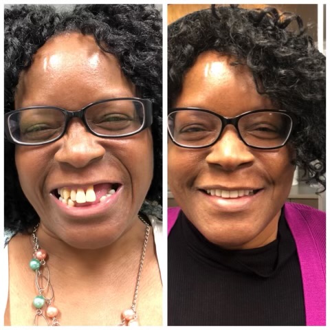 Smyle Upper East Side before and after transformation 3